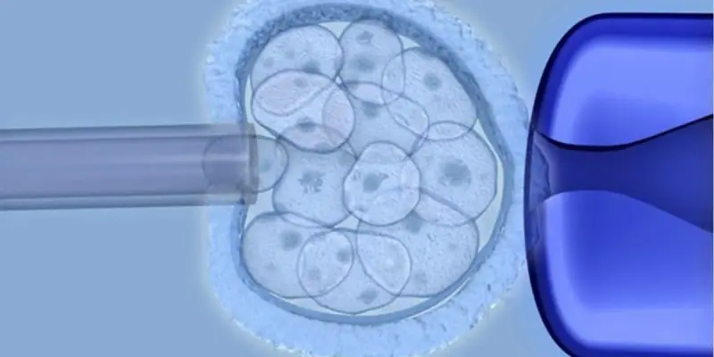 Estudio encuentra que las células madre derivadas del cordón umbilical son eficaces en pacientes con parálisis cerebral